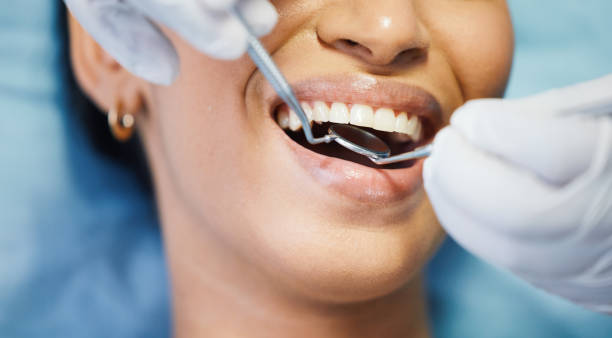 Best Emergency Root Canal Treatment in Sandusky, MI