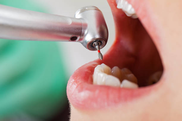 Best Weekend Emergency Dentist in Sandusky, MI